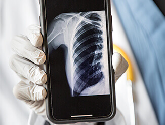 X-ray image on smart phone
